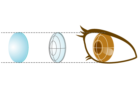 step3 フィッティング