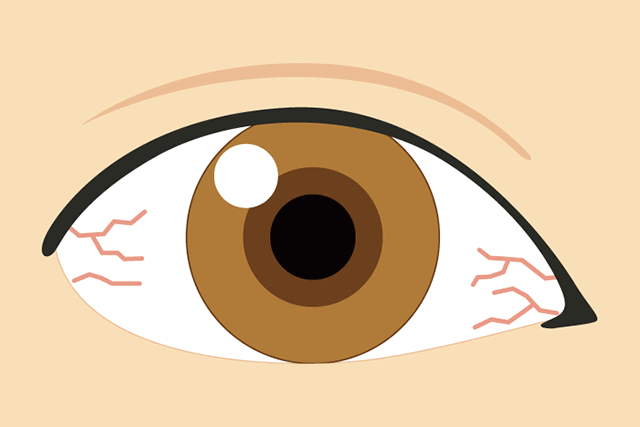 ドライアイとは？