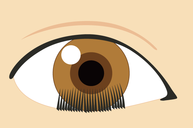 眼瞼内反症（がんけんないはんしょう）